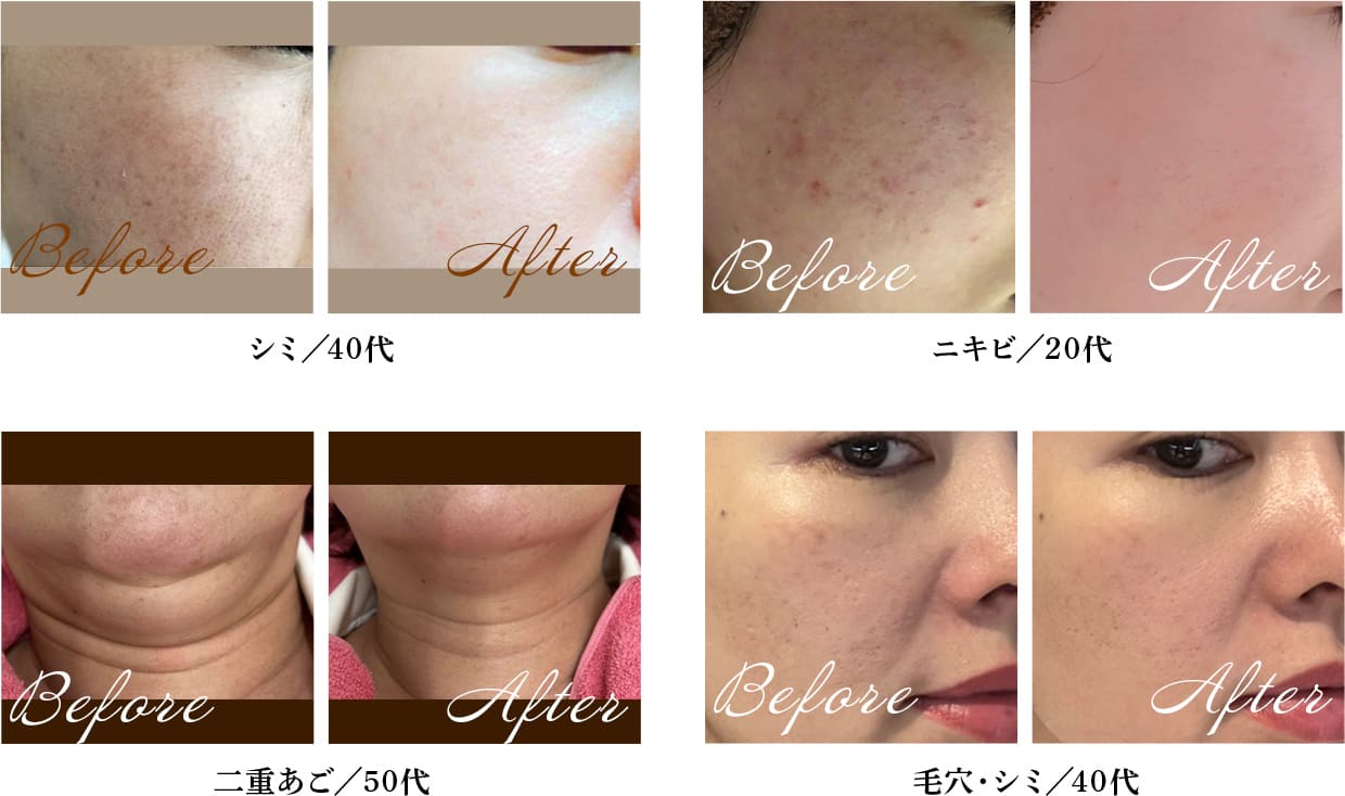 ビフォーアフター紹介